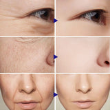 Vitamin C Facial Serum benefits - hydration and oil balance skincare